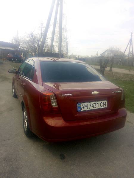 Chevrolet Lacetti 2010  випуску Київ з двигуном 1.6 л газ седан механіка за 5500 долл. 